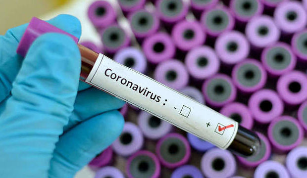 Koronavirusa yoluxanların sayı açıqlanıb