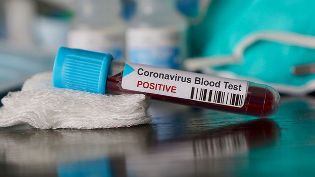 Koronavirusa yoluxanların sayı açıqlanıb