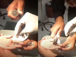 Bakıda azyaşlının barmağında dəmir halqa sıxışdı