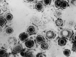 Anksiyete pozğunluğunun yeni səbəbi kəşf edildi Anksiyete pozğunluğunun yeni səbəbi kəşf edildi