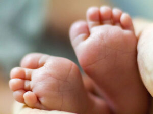 Saranskda üç aylıq körpə kartof ilə kompresdən yanıq alıb