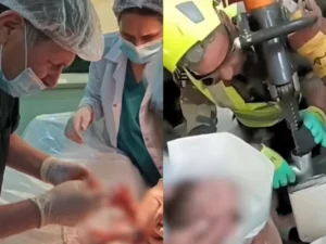 Əli ətçəkən maşınında qalan körpə ciddi xəsarət almadan xilas olundu