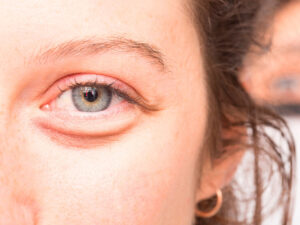 Görmə qabiliyyətinin itirilməsi üçün faydalı olan idman növləri sadalanır