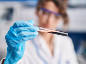 Alimlər qanı sümüklərin və digər bədən toxumalarının bərpası üçün materiala çeviriblər