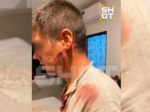 Hindistanda naməlum şəxslər rus turistlərə pala ilə hücum edib