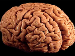 Elm adamları: çirkli hava ilə nəfəs almaq beyində təhlükəli “fırtına” yaradır