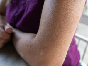 Alimlər dəri hüceyrələrinin bir-biri ilə “danışdığını” aşkar ediblər