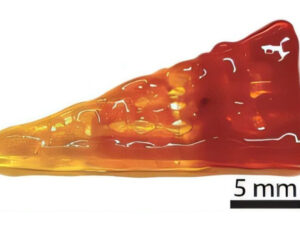 Alimlər menisküsün bərpası üçün inqilabi hidrogel yaradıblar