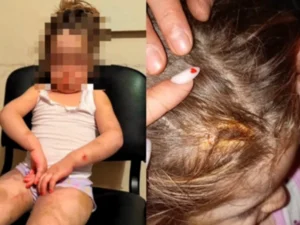 Bakıda ağır işgəncəyə məruz qalan azyaşlı anasından alındı