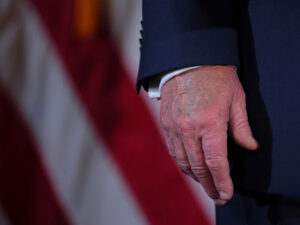 Jurnalistlər Trampın qolunda yenidən qançır görüblər