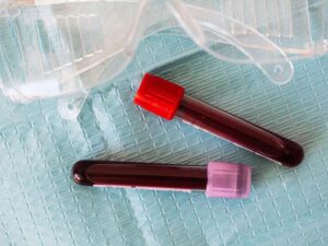Bioloji yaşı ən dəqiq göstərən testlərin adı açıqlanıb