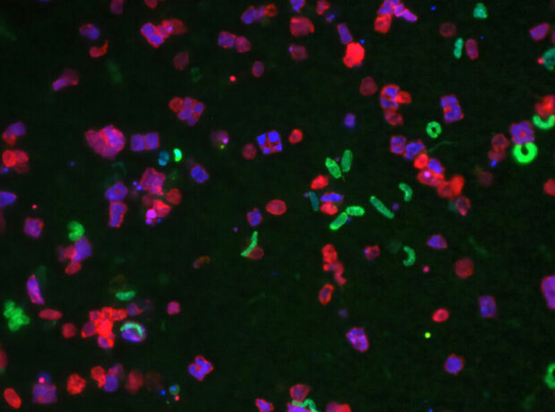 Alimlər bakteriyaların kosmos uçuşundan sağ çıxa bilib-bilmədiyini kəşf ediblər Alimlər bakteriyaların kosmos uçuşundan sağ çıxa bilib-bilmədiyini kəşf ediblər
