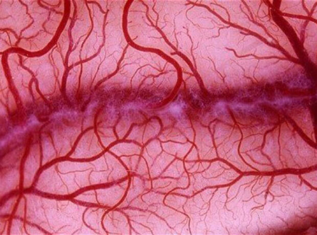 Həkim ildə neçə dəfə damar rentgen müayinəsinin aparıla biləcəyini izah etdi Həkim ildə neçə dəfə damar rentgen müayinəsinin aparıla biləcəyini izah etdi