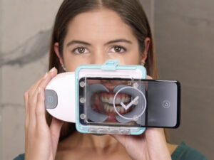 Həkim xəbərdarlıq etdi ki, tüpürcəyin düzgün udulması dişləmənin təsirinə səbəb ola bilər Həkim xəbərdarlıq etdi ki, tüpürcəyin düzgün udulması dişləmənin təsirinə səbəb ola bilər