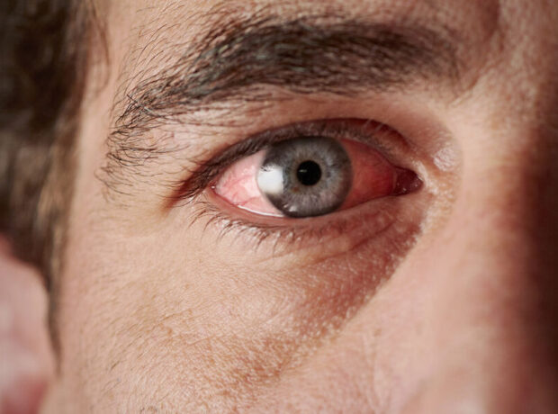 Həkim yaşlı insanların niyə gözləri sulu olduğunu izah etdi Həkim yaşlı insanların niyə gözləri sulu olduğunu izah etdi