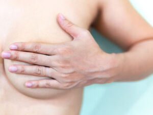 Alimlər əməliyyat gözləyərkən döş xərçənginin nə qədər tez inkişaf etdiyini aşkar ediblər Alimlər əməliyyat gözləyərkən döş xərçənginin nə qədər tez inkişaf etdiyini aşkar ediblər