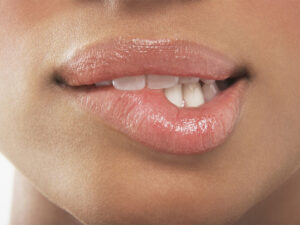 Nevroloq dodaqlarınızın küncləri qıcqırırsa nə etməli olduğunu izah etdi Nevroloq dodaqlarınızın küncləri qıcqırırsa nə etməli olduğunu izah etdi