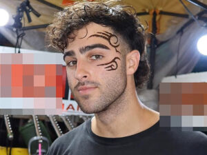 Taylandda turist müvəqqəti döymə etdirdikdən sonra üzündə qabarcıqlar əmələ gəlib