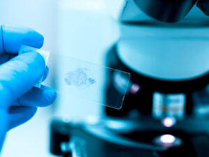 Mədə xorası və mədə-bağırsaq xərçənginə kömək edən bir məhsul açıqlanıb